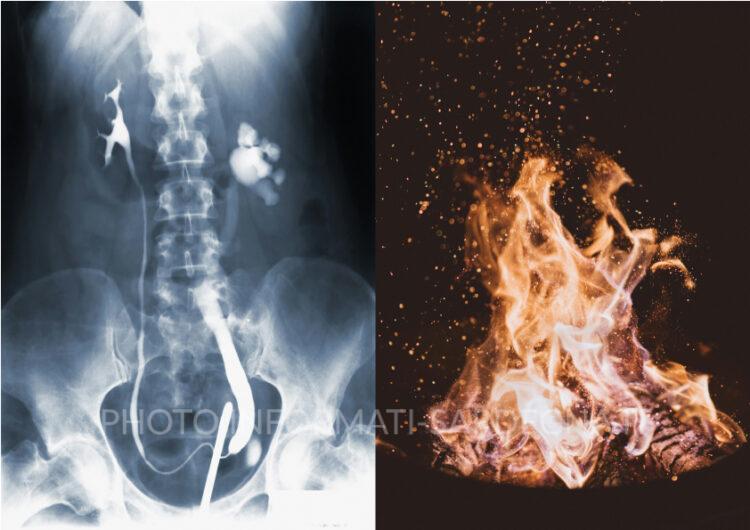 Foto di CDC e Joshua Newt su Unsplash